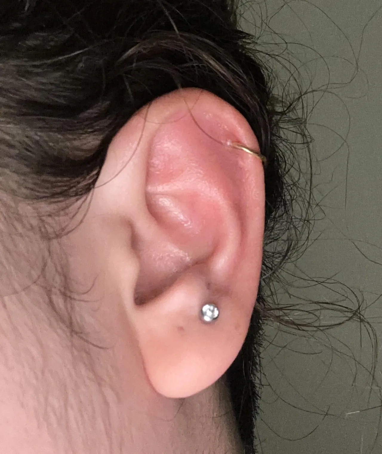 Jak skutecznie leczyć infekcję piercingu i uniknąć powikłań