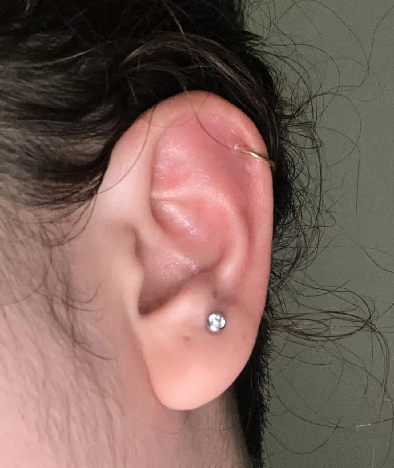 Jak skutecznie leczyć infekcję piercingu i uniknąć powikłań